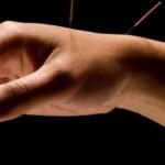 El significado de soñar con agujas clavadas en la mano